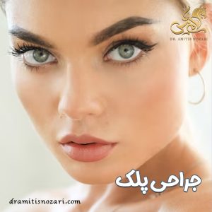 جراحی پلک - دکتر آمی تیس نوذری