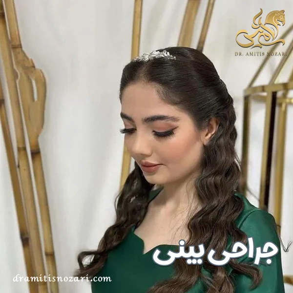 جراحی بینی - دکتر آمی تیس نوذری