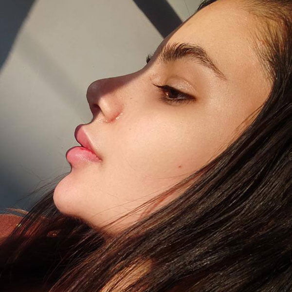 rhinoplasty-dramitisnozari-com-4