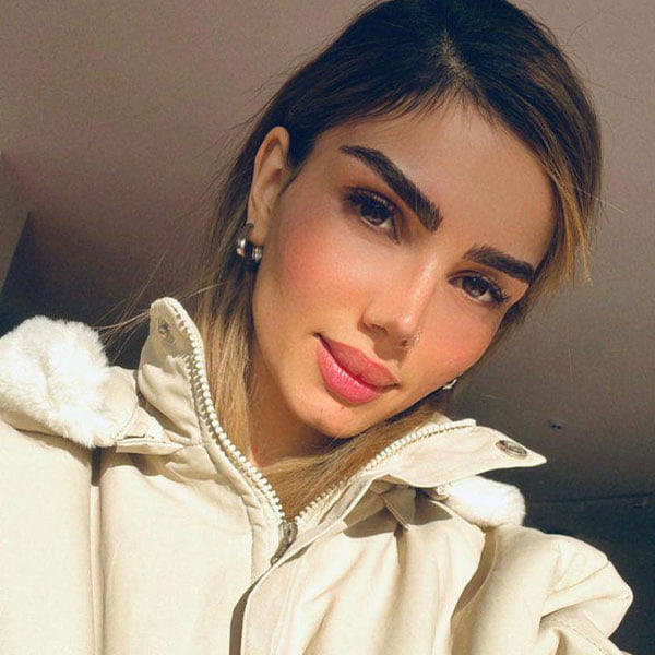 rhinoplasty-dramitisnozari-com-6