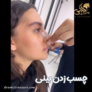 چسب زدن بینی بعد از جراحی + دکتر آمی تیس نوذری