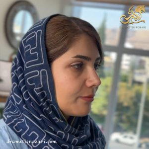 نمونه کار جراحی بینی استخوانی 2- دکتر امی تیس نوذری 