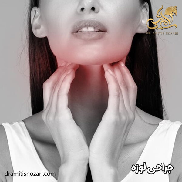 جراحی لوزه - دکتر آمی تیس نوذری
