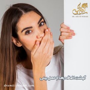 گوشت اضافه بعد از جراحی بینی - دکتر آمی تیس نوذری