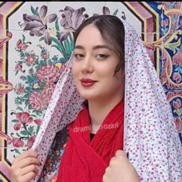 جراحی بینی 2- دکتر امی تیس نوذری