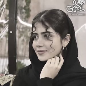 جراحی بینی 3- دکتر امی تیس نوذری