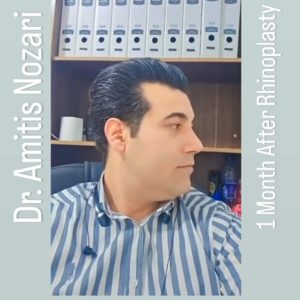 جراحی بینی 6 - دکتر آمی تیس نوذری