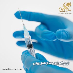 تزریق کورتون بعد از عمل بینی - دکتر آمی تیس نوذری 