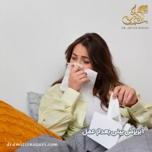 آبریزش بینی بعد از عمل - دکتر آمی تیس نوذری 