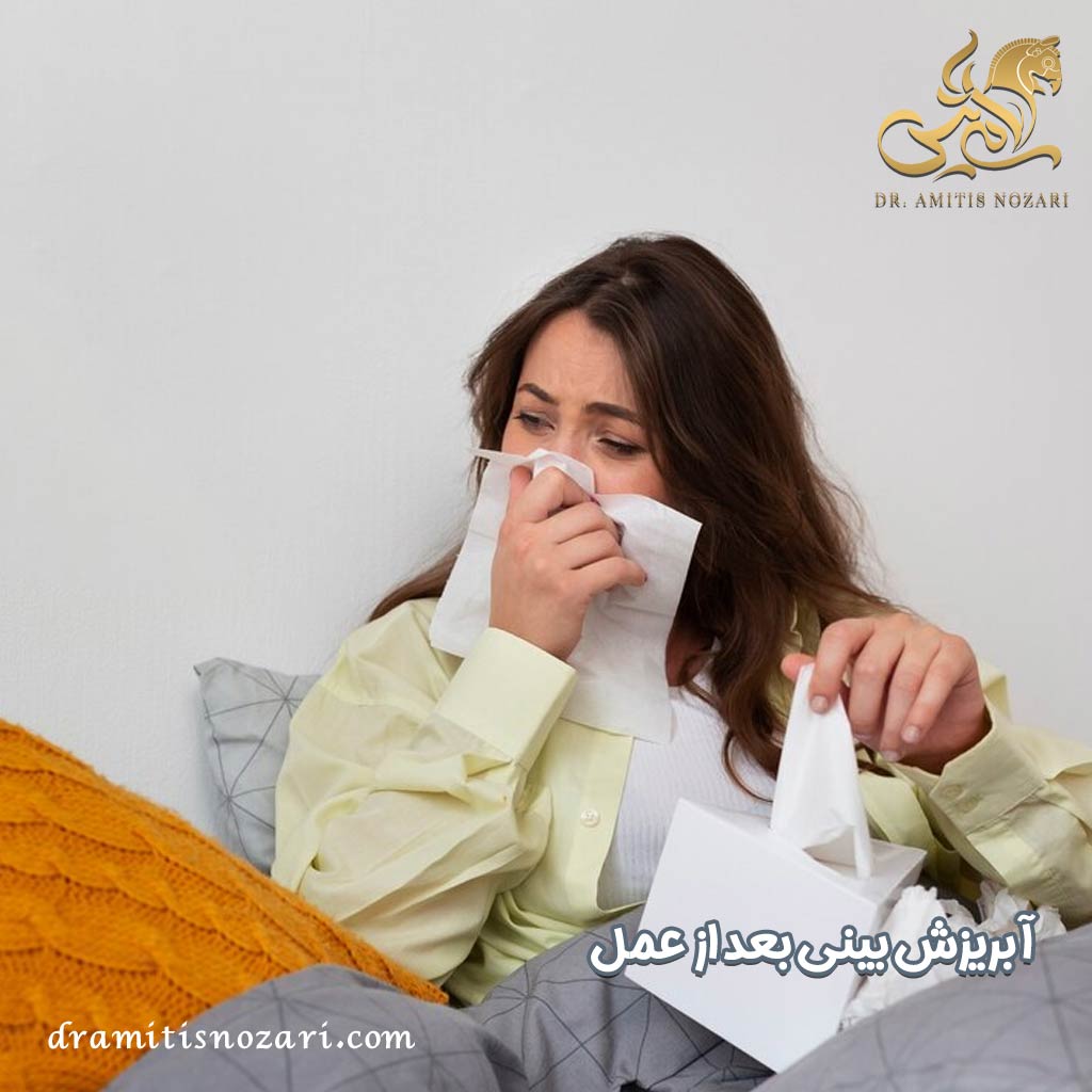 آبریزش بینی بعد از عمل - دکتر آمی تیس نوذری