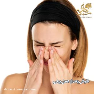 خارش بینی بعد از عمل - دکتر آمی تیس نوذری 