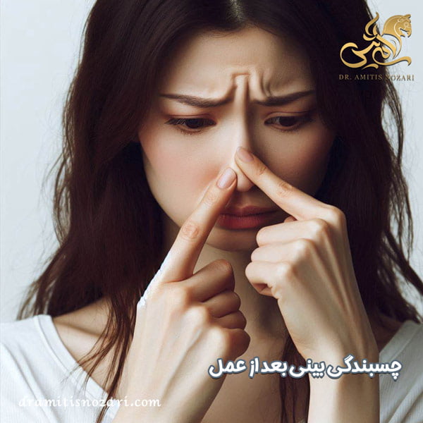 چسبندگی بینی بعد از عمل - دکتر آمی تیس نوذری