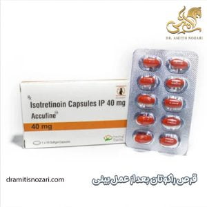 مصرف قرص راکوتان بعد از عمل بینی - دکتر آمی تیس نوذری 