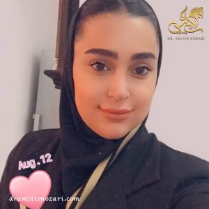 نمونه جراحی بینی 1