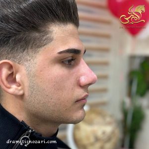 بهترین جراح بینی مردانه 1- دکتر نوذری 