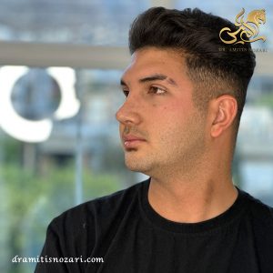 بهترین جراح بینی مردانه 3- دکتر نوذری