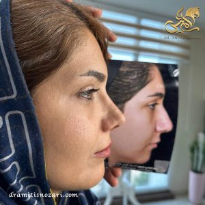 عمل بینی طبیعی در تهران 2