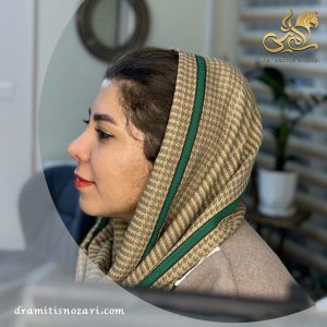 جراحی بینی طبیعی 1 
