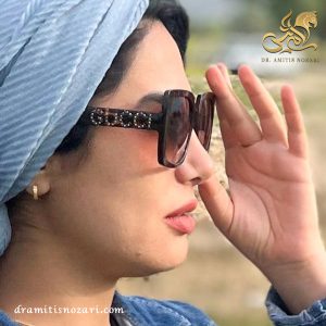 جراحی بینی طبیعی 3 