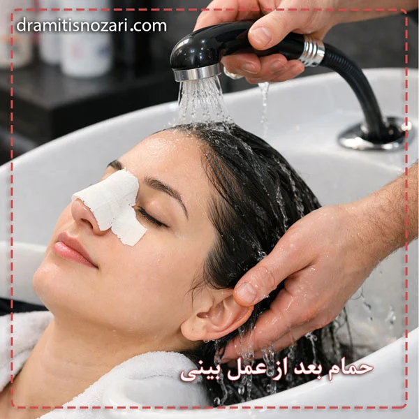 حمام بعد از عمل بینی - دکتر نوذری