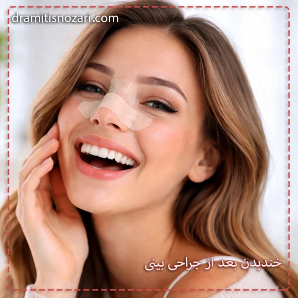 خندیدن بعد از جراحی بینی - دکتر نوذری