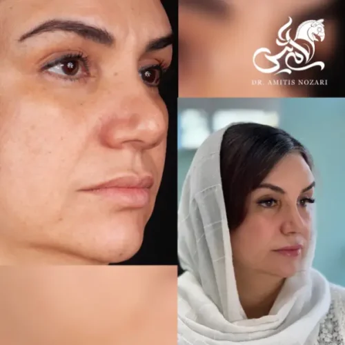 نمونه-کار-دکتر-آمیتیس-نوذری-56