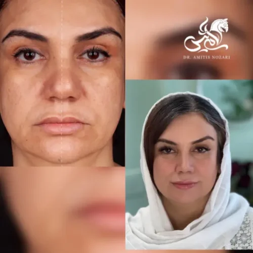 نمونه-کار-دکتر-آمیتیس-نوذری-58