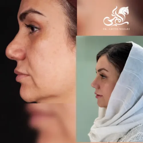 نمونه-کار-دکتر-آمیتیس-نوذری-59